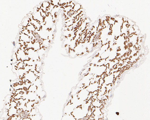 AP4M1 Antibody in Immunohistochemistry (Paraffin) (IHC (P))