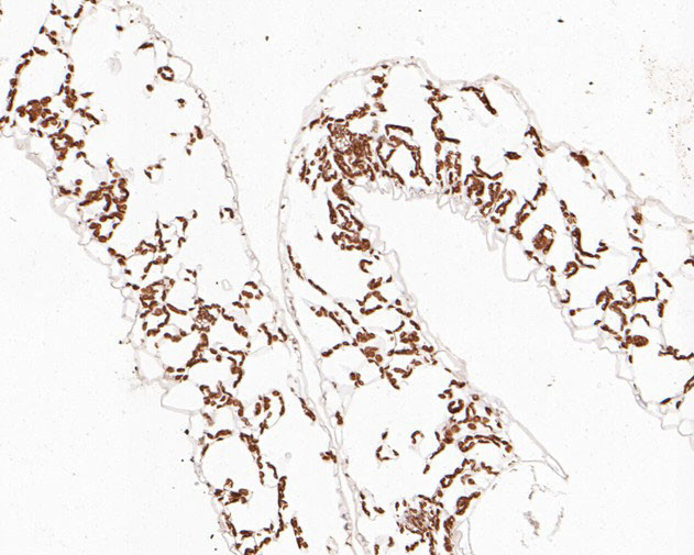 AP4S1 Antibody in Immunohistochemistry (Paraffin) (IHC (P))