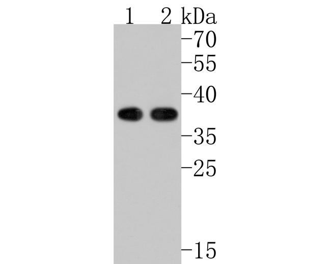 PHF11 Antibody in Western Blot (WB)