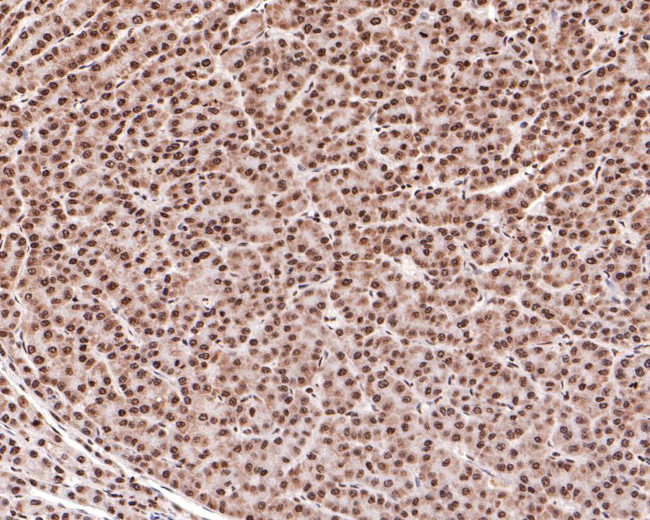RAD52 Antibody in Immunohistochemistry (Paraffin) (IHC (P))
