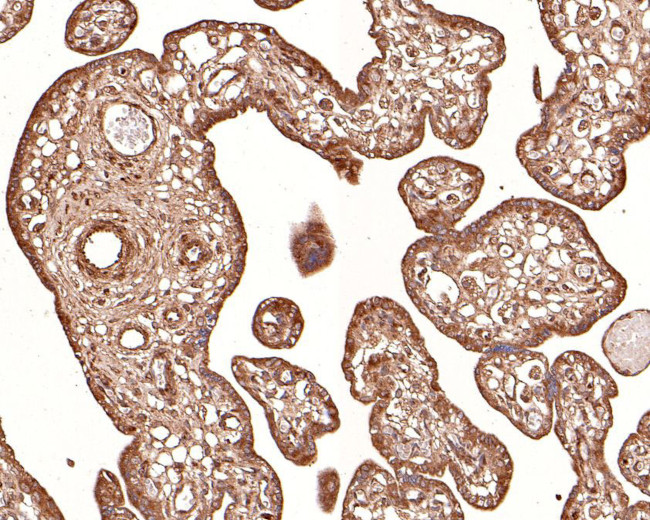 RNF111 Antibody in Immunohistochemistry (Paraffin) (IHC (P))