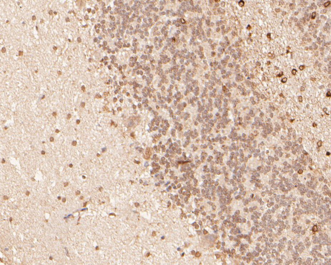 CDX4 Antibody in Immunohistochemistry (Paraffin) (IHC (P))