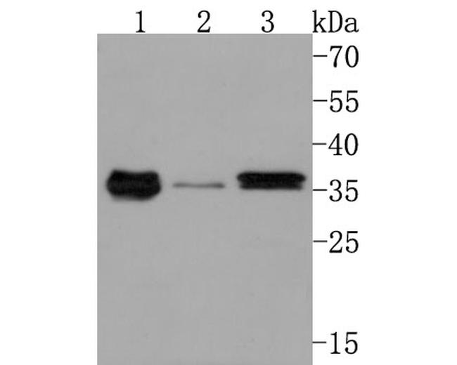GNB4 Antibody in Western Blot (WB)