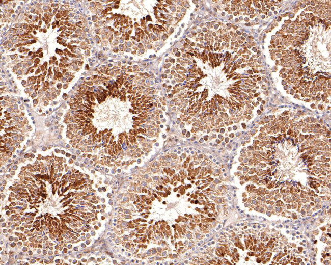 CIS Antibody in Immunohistochemistry (Paraffin) (IHC (P))