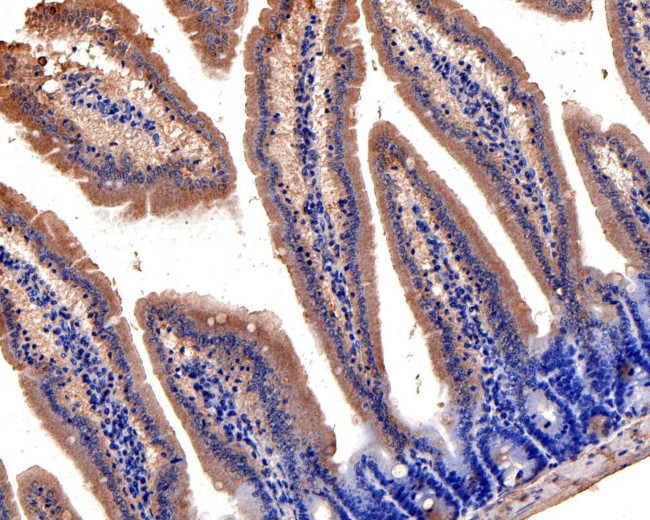 CLIC5 Antibody in Immunohistochemistry (Paraffin) (IHC (P))