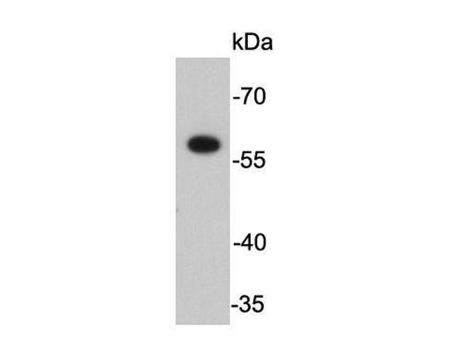 FokI Antibody in Western Blot (WB)