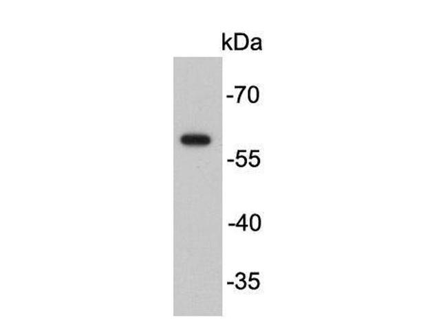 FokI Antibody in Western Blot (WB)