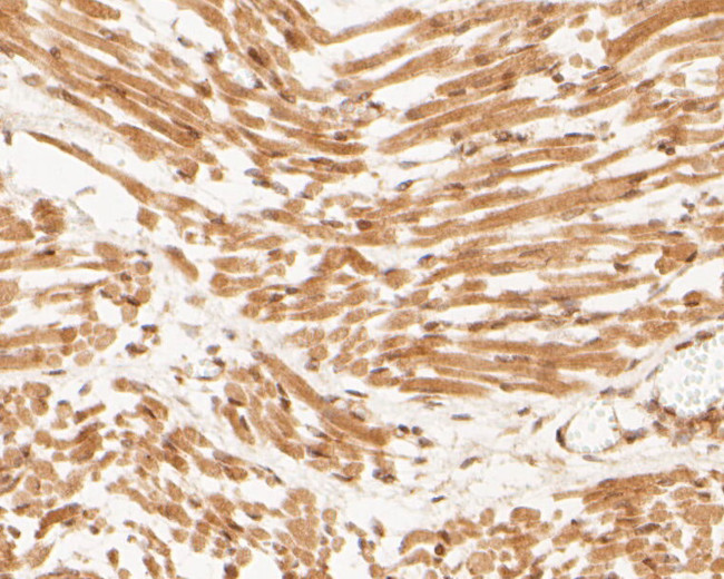 ID2 Antibody in Immunohistochemistry (Paraffin) (IHC (P))
