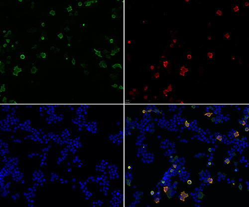 Retrovirus-related Gag Antibody in Immunocytochemistry (ICC/IF)