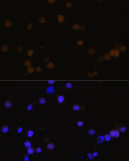 Rb Antibody in Immunocytochemistry (ICC/IF)
