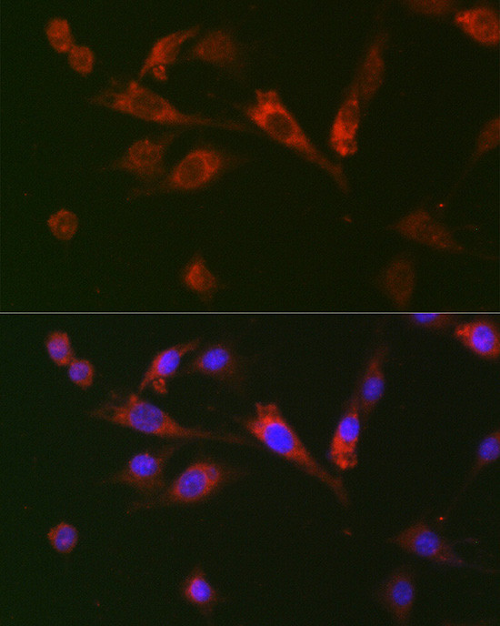 GDF15 Antibody in Immunocytochemistry (ICC/IF)