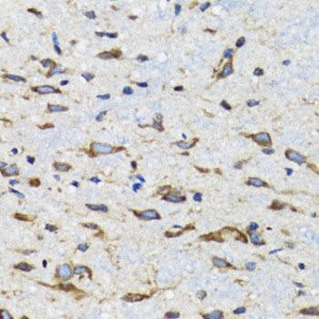 CDK1 Antibody in Immunohistochemistry (Paraffin) (IHC (P))