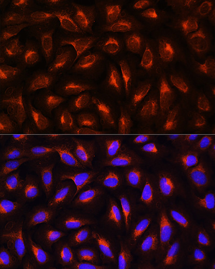 CRP Antibody in Immunocytochemistry (ICC/IF)