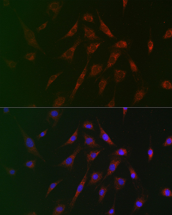 TSC2 Antibody in Immunocytochemistry (ICC/IF)