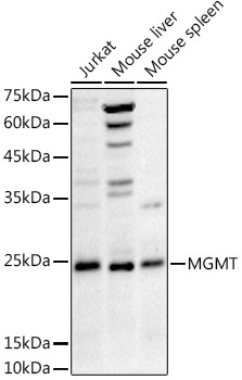 MGMT Antibody in Western Blot (WB)