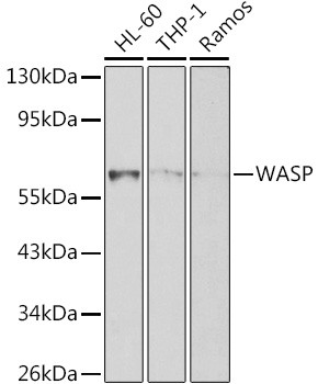 WASP Antibody in Western Blot (WB)