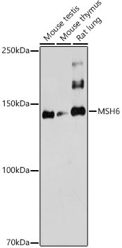 MSH6 Antibody in Western Blot (WB)