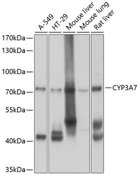 CYP3A7 Antibody in Western Blot (WB)