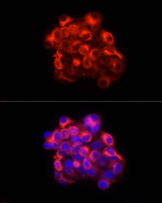 Cytokeratin 18 Antibody in Immunocytochemistry (ICC/IF)