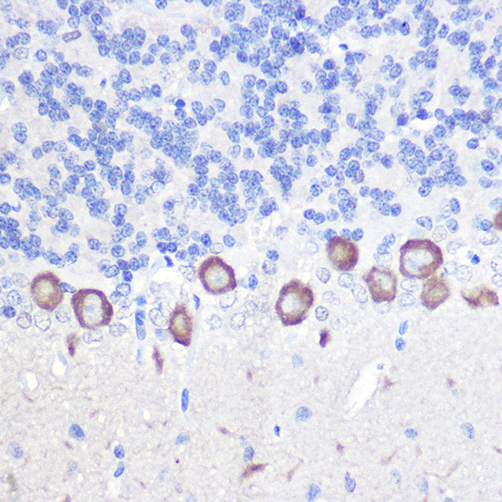 PLCB3 Antibody in Immunohistochemistry (Paraffin) (IHC (P))