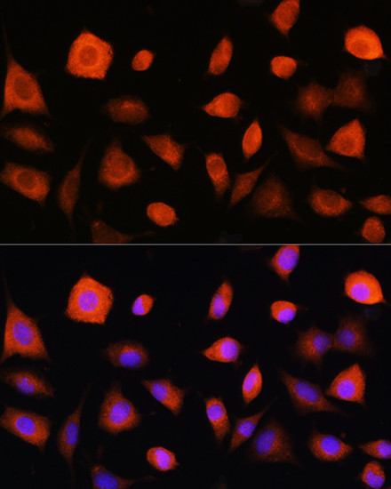 eIF2b epsilon Antibody in Immunocytochemistry (ICC/IF)