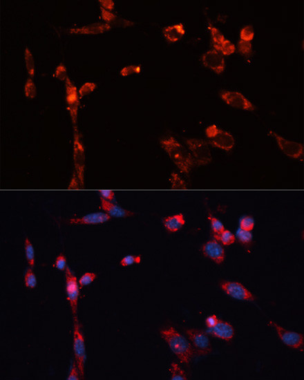 MMP16 Antibody in Immunocytochemistry (ICC/IF)