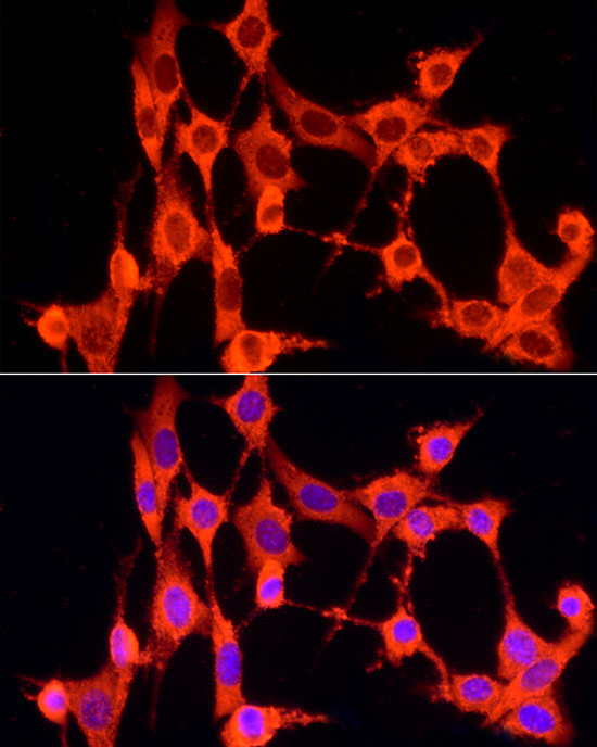 GCH1 Antibody in Immunocytochemistry (ICC/IF)