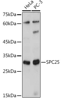 SPC25 Antibody in Western Blot (WB)