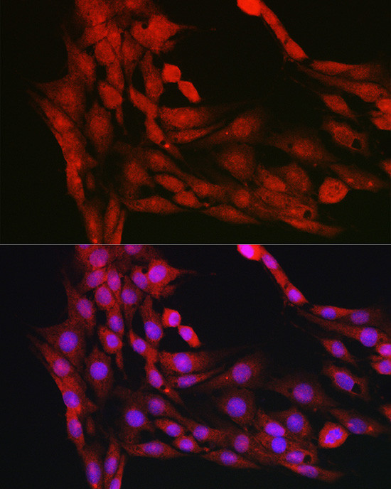 AKT1 Antibody in Immunocytochemistry (ICC/IF)