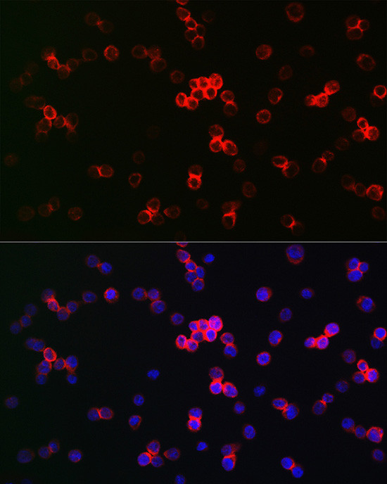 IRF3 Antibody in Immunocytochemistry (ICC/IF)