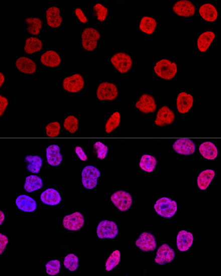 Histone H2A.X Antibody in Immunocytochemistry (ICC/IF)