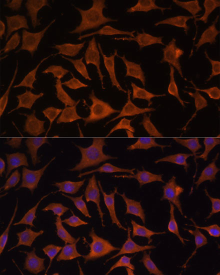 TNF alpha Antibody in Immunocytochemistry (ICC/IF)
