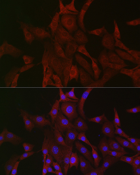 PAK4 Antibody in Immunocytochemistry (ICC/IF)