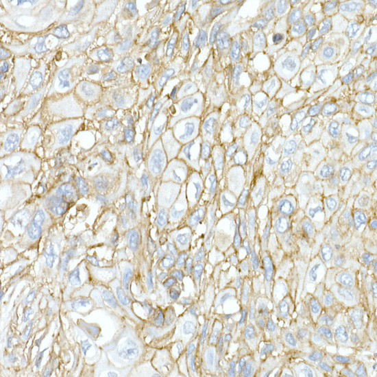 JAM-A (CD321) Antibody in Immunohistochemistry (Paraffin) (IHC (P))