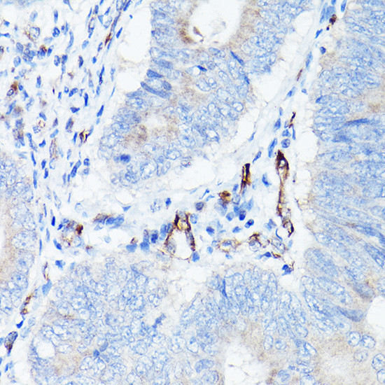 VE-cadherin Antibody in Immunohistochemistry (Paraffin) (IHC (P))