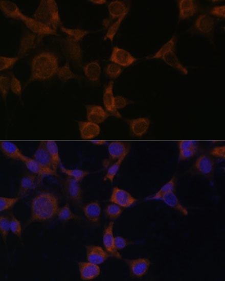 AMPK beta-1 Antibody in Immunocytochemistry (ICC/IF)