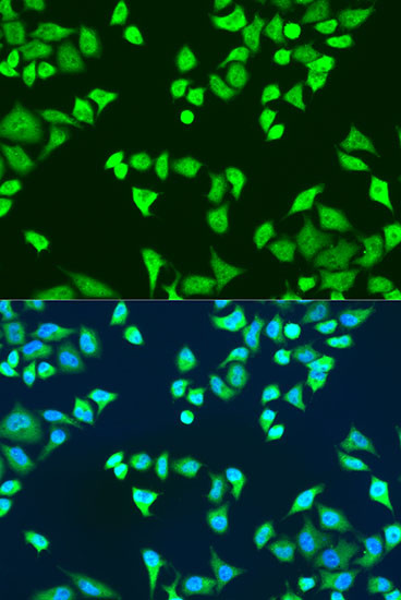 SMN2 Antibody in Immunocytochemistry (ICC/IF)