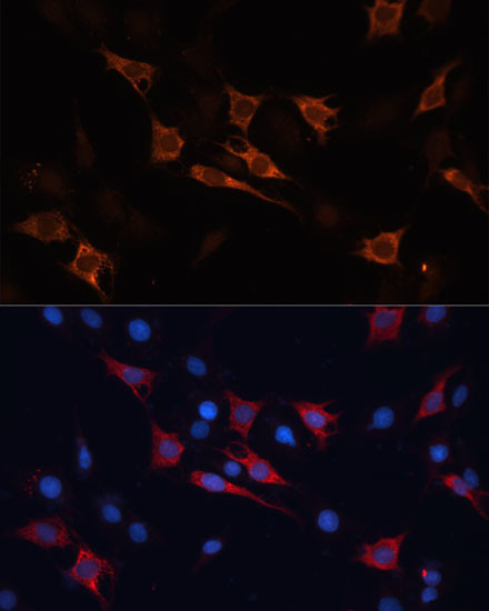 HSP70 Antibody in Immunocytochemistry (ICC/IF)