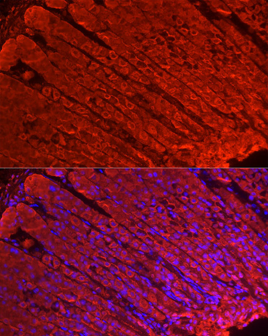ALDH3A1 Antibody in Immunocytochemistry (ICC/IF)