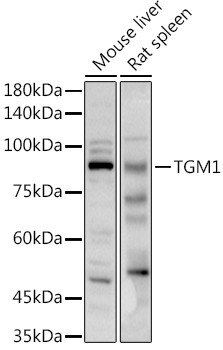 TGM1 Antibody in Western Blot (WB)