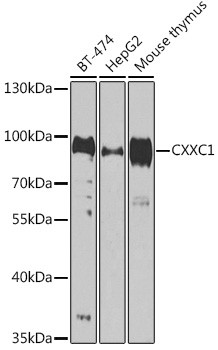 CGBP Antibody in Western Blot (WB)