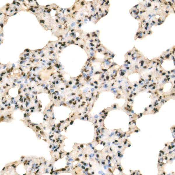 RbAp46 Antibody in Immunohistochemistry (Paraffin) (IHC (P))