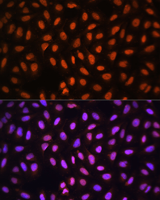 MCM5 Antibody in Immunocytochemistry (ICC/IF)