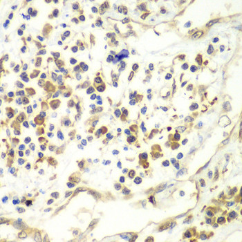 UPF1 Antibody in Immunohistochemistry (Paraffin) (IHC (P))