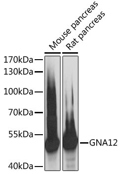 GNA12 Antibody in Western Blot (WB)