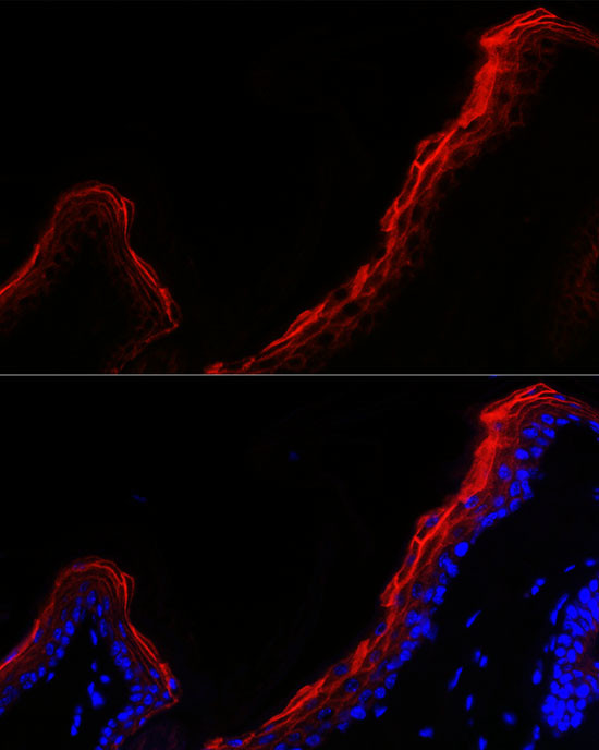 Periplakin Antibody in Immunocytochemistry (ICC/IF)