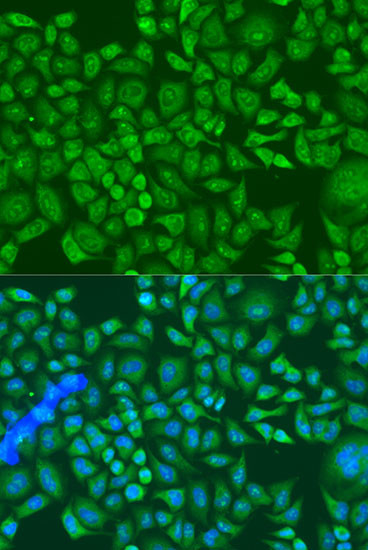 IGF2BP2 Antibody in Immunocytochemistry (ICC/IF)