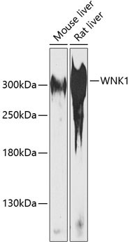 WNK1 Antibody in Western Blot (WB)