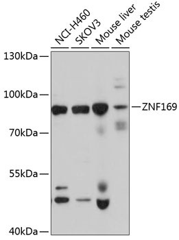ZNF169 Antibody in Western Blot (WB)