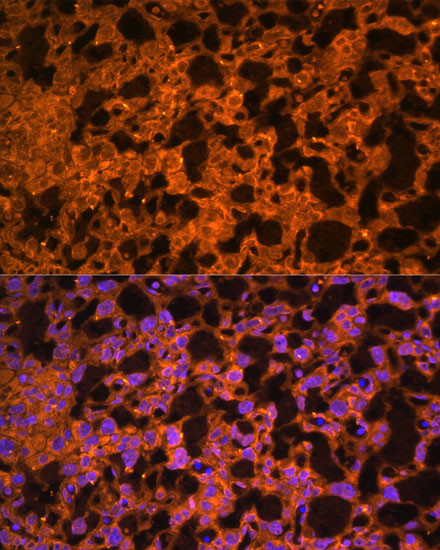 LAIR2 Antibody in Immunohistochemistry (Paraffin) (IHC (P))